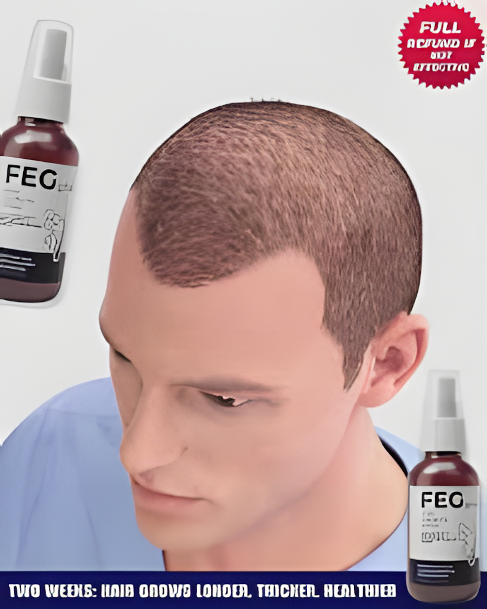 FEG Plus Hair Growth Spray – Fast Hair Regrowth & Anti Hair Fall Solution