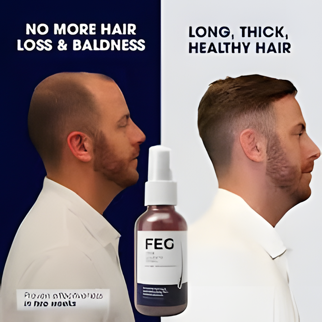 FEG Plus Hair Growth Spray – Fast Hair Regrowth & Anti Hair Fall Solution